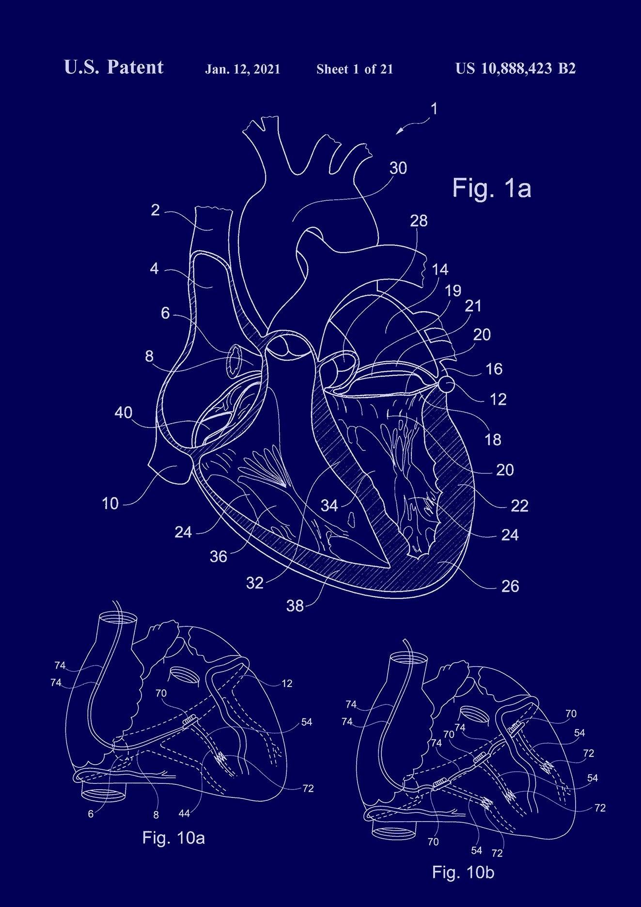 Heart patent 2024