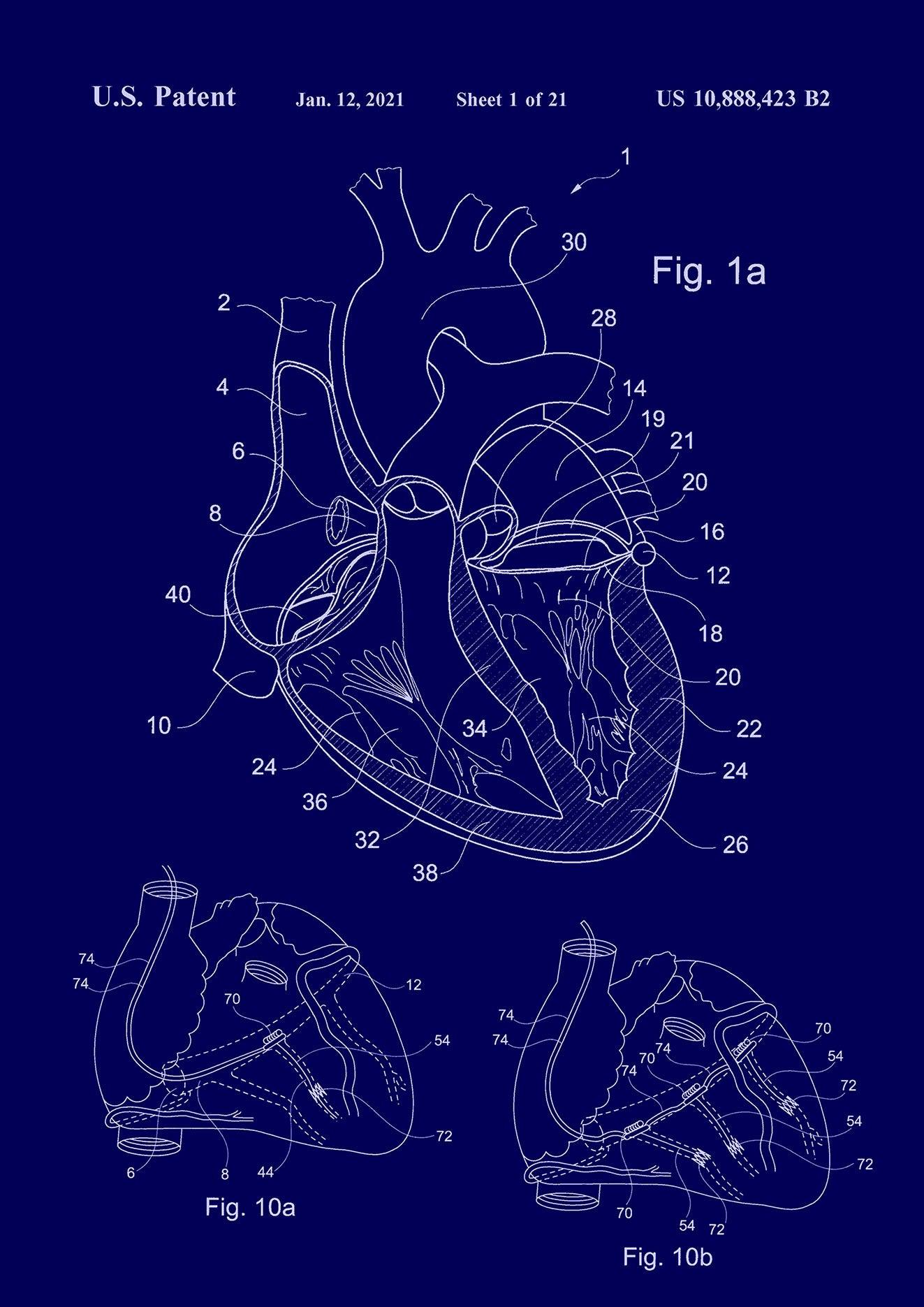 HEART PATENT PRINT: Medical Blueprint Artwork - Pimlico Prints